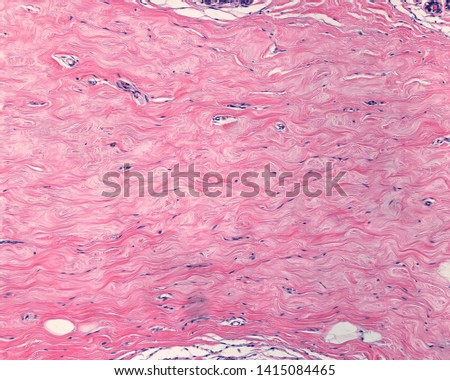 The interlobular breast stroma is a dense connective tissue with intermingled ondulated bundles of collagen fibers Stock photo © 