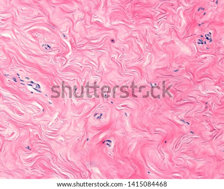 The interlobular breast stroma is a dense connective tissue with intermingled ondulated bundles of collagen fibers Stock photo © 