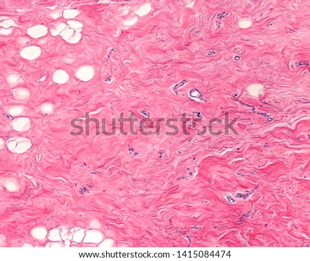 The interlobular breast stroma is a dense connective tissue with intermingled ondulated bundles of collagen fibers and a variable amount of adipocytes. Stock photo © 