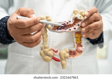 Intestine, appendix and digestive system, doctor holding anatomy model for study diagnosis and treatment in hospital. - Shutterstock ID 2321667861