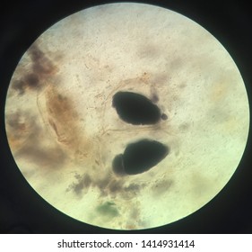 Intracellular Starch Granules In Feces Analysis