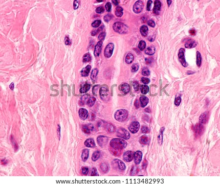 Intradermal portion of excretory duct of an eccrine sweat gland, lined by a stratified epithelium formed by two layers of cuboidal cells. 