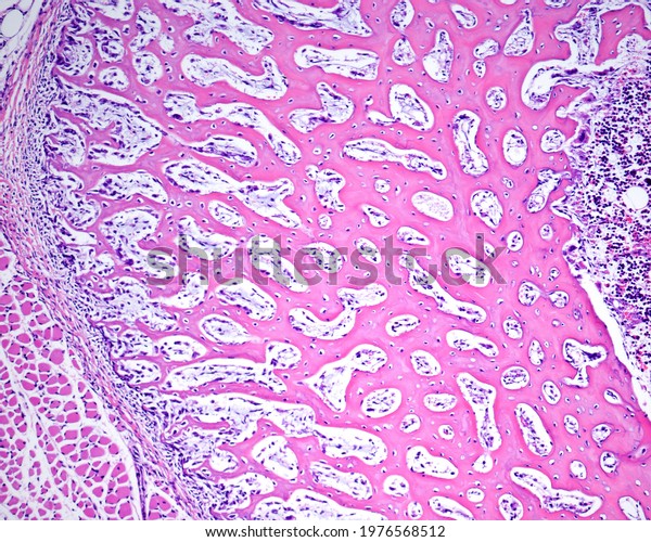Intramembranous ossification. Cross-sectioned\
immature bone (diaphysis). The periosteum surrounds the cortical of\
primary woven bone formed by a network of bone trabeculae. At\
right, the bone\
marrow