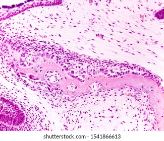 Intramembranous Ossification. Immature Bone Trabeculae Showing A Upper Rim Of Osteoblasts And Some Osteoclasts In The Opposite Side.