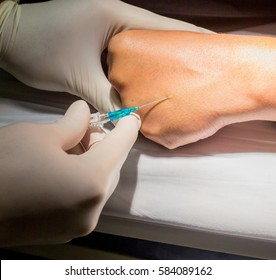 Intravenous Cannulation