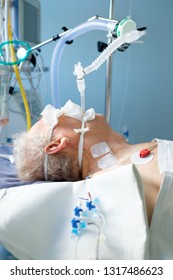 Intubated Adult White Man Under Avl Stock Photo (Edit Now) 1317486623