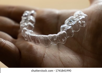 Invisalign Braces On Hand. Invisible Transparent Aligner Or Clear-plastic Retainers.