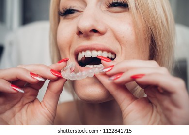 Invisible braces aligner, woman smiling - Shutterstock ID 1122841715