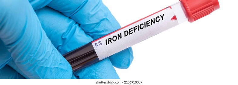 iron-deficiency-iron-deficiency-disease-blood-stock-photo-2156910387