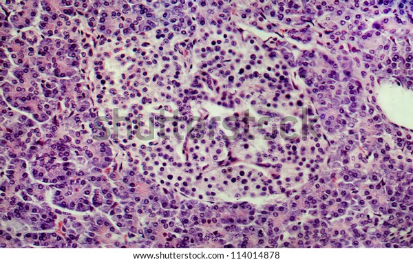 Islet Langerhans Human Pancreas Magnification 300x Stock Photo (Edit ...