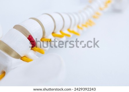Isolated anatomy spine model on white space background.Orthopedic surgery education about herniated intervertebral disc in patient with back and leg pain.White skeleton and yellow nerve root with HNP.