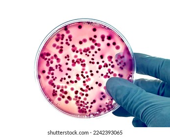 Isolated dark red and pink colonies of mixed bacteria such as E. coli, Salmonella or Enterobacteriaceae that growing on red agar plate 