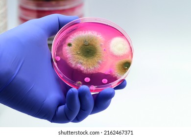 Isolated fungal colonies in the laboratory