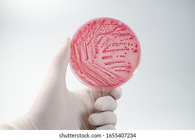 Isolated pink colony or colonies on the pink agar. Isolated lactose-fermenting bacteria produce colonies on MacConkey agar (MAC). Gram negative rod or bacilli - Shutterstock ID 1655407234