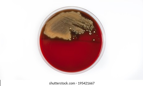 Isolation of throat swab on petri dish on white backround