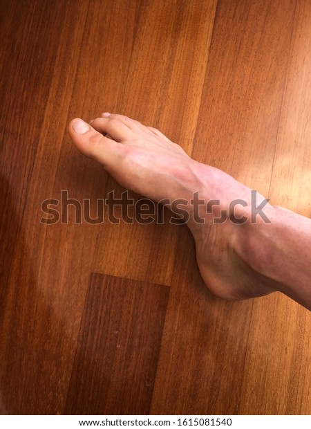 Italian feet in 