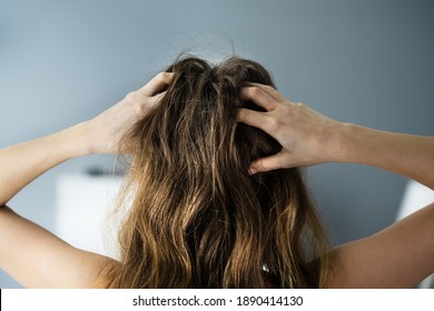 Itching Dry Head Scalp And Long Hair With Dandruff