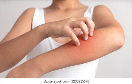 Itching of skin diseases in man using the hand-scratching. Red around the Itching area. The concept with Healthcare And Medicine.
