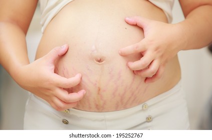The  itchings of pregnant belly