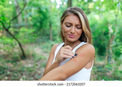Picor picante de insectos - Una joven irritada rascando su brazo picante de una picadura de mosquito en el parque durante el verano.