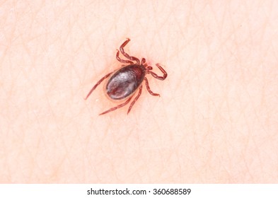 Ixodes Ricinus