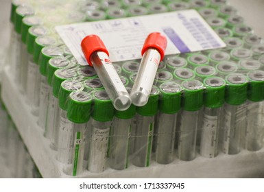 Jalandhar, Punjab/ India - April 20 2020: View Of Testing Medical Vials Useful In Various Blood Sample Collections