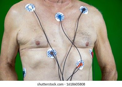 January 7, 2020 - New Cumberland, PA, USA - Man Wearing Heart Portable Heart Monitor At Home Against Removable Green Screen.