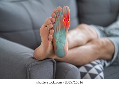 Joint diseases, hallux valgus, plantar fasciitis, man's leg hurts, pain in the foot, health problems concept - Shutterstock ID 2085715516