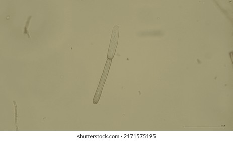 KAOHSIUNG,TAIWAN-DECEMBER,2019:Identification Of Corynespora Cassiicola Conidia In Corynespora Leaf Spot Disease Of Cucumis Sativus L.