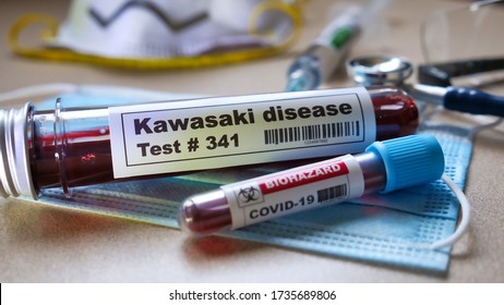 Kawasaki disease test coronavirus covid-19
