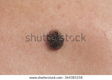 Similar – umbilicus Fluff Navel