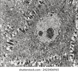 Keratinocyte of spinous layer with a polygonal shape, central nucleus with nucleolus, cytoplasm full of keratin filament bundles, and numerous dark desmosomes crossing the intercellular spaces