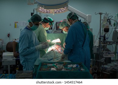 Khan Yunis, Gaza Strip/Palestine - Feb 23 2015: European Gaza Hospital,	The Italian Cardiac Surgery Team At Work In The Operating Room.