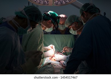 Khan Yunis, Gaza Strip/Palestine - Feb 23 2015: European Gaza Hospital,	The Italian Cardiac Surgery Team At Work In The Operating Room.