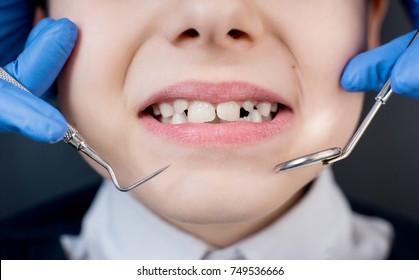 Kid Showing Teeth At Dental Check Up. Close-up Of Dentist's Hand With Dental Tools - Probe And Mirror In Dental Office. Dentistry