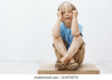 Kid Wants Attention, Feeling Alone And Upset. Portrait Of Gloomy Unhappy Cute Boy With Blond Hair And Vitiligo, Crying Or Whining, Holding Hands Over Face, Calling Mom Over Gray Wall