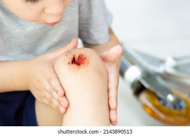 Kid Who Fell On The Asphalt And Sustained A Knee Injury With The Electric Scooter