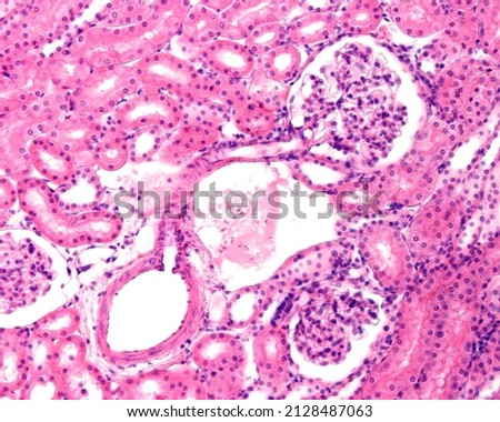 
Kidney. The micrograph shows the continuity between an interlobular artery and the exit of an afferent arteriole directed towards a renal corpuscle where it continues with the vascular tuft. Stock photo © 
