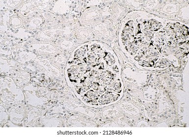 Kidney. Renal Corpuscle Podocytes Stained With An Immunohistochemical Technique To Detect Vimentin Protein