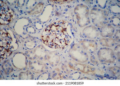 Kidney Sample Displaying Bowman's Capsule And Glomerulus.