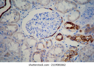 Kidney Sample Displaying Bowman's Capsule And Glomerulus.