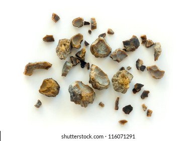 Kidney Stones Images Stock Photos Vectors Shutterstock