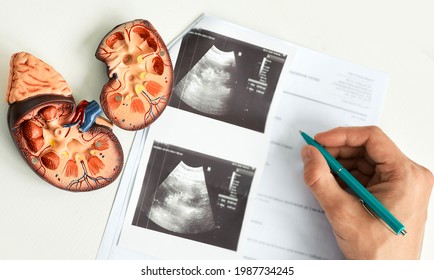 Kidney ultrasound. Doctor analyzing of patient kidney health using kidney ultrasound - Shutterstock ID 1987734245