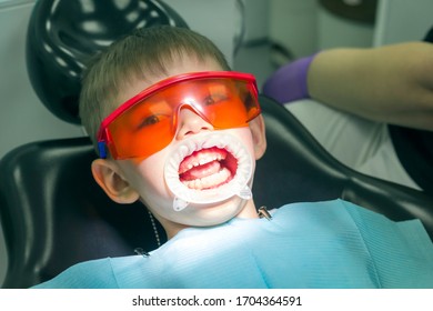 Kids dentistry. Children's dentist examination baby teeth. Emotions of a child in a dental chair. Little boy in protective orange glasses and cofferdam. Process treatment caries. - Powered by Shutterstock