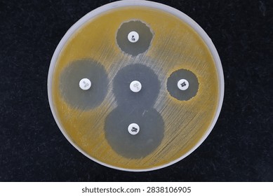 The Kirby bauer disc diffusion method of testing antibiotic susceptibility of Staphylococcus aureus