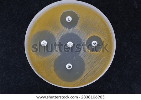 The Kirby bauer disc diffusion method of testing antibiotic susceptibility of Staphylococcus aureus
