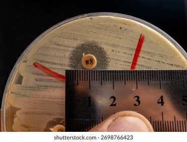 Kirby-Bauer Disk Diffusion Susceptibility Test Analysis