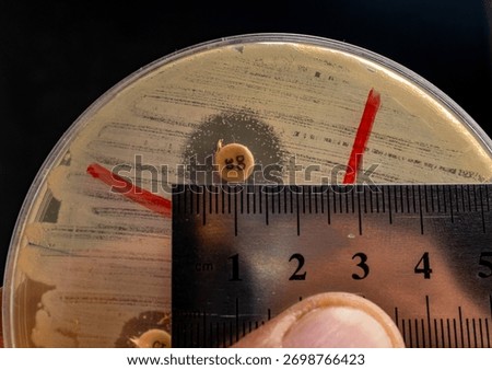 Kirby-Bauer Disk Diffusion Susceptibility Test Analysis