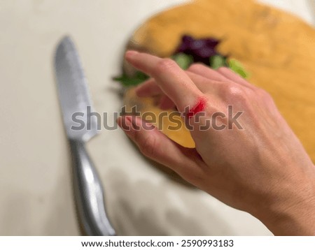 Kitchen accident: Hand cut while preparing fresh salad
