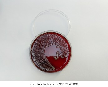 
Klebsiella pneumonia or Klebsiella spp.; bacterial culture growth on Blood agar. top view
